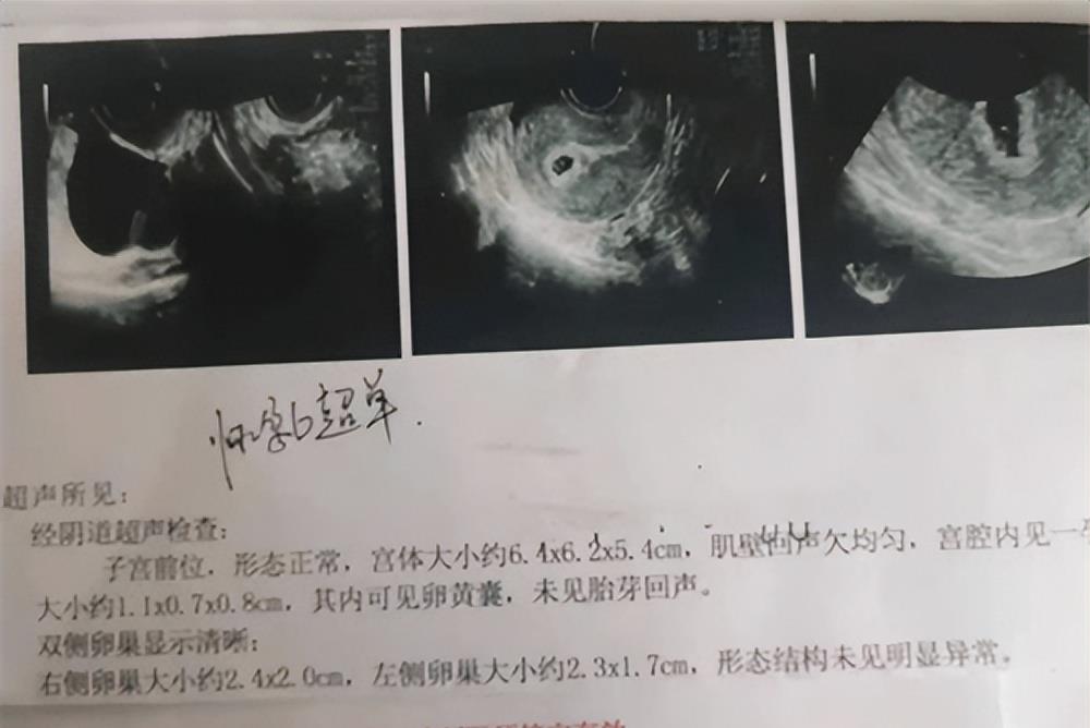 街拍|案例回顾：黑龙江一起因姐妹“互换丈夫”引发的伦理悲剧