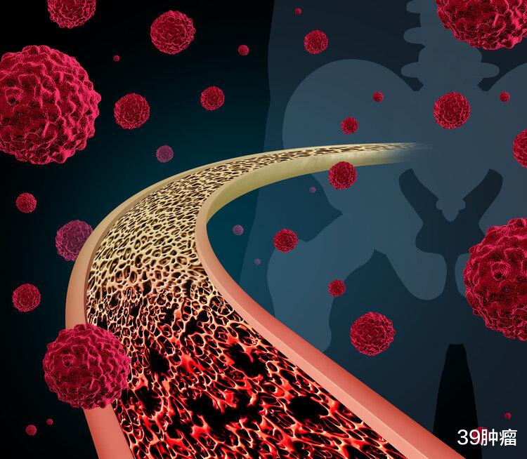 肺癌|体内有癌,“腿”知道?提醒:腿部出现3个怪象,或是癌症预兆