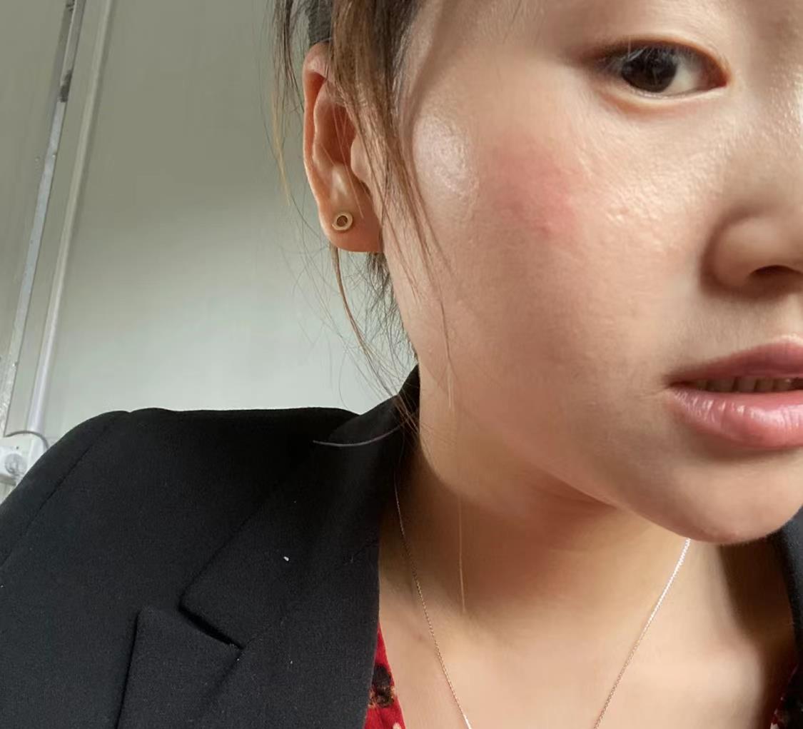 抗氧化 30、40岁的女人想要抗衰老,别着急用“视黄醇”,这样做更有效