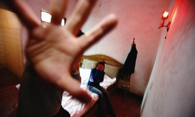 尿蛋白|艾滋来上门时多久能发觉?很多人不了解,为了健康尽量多留心