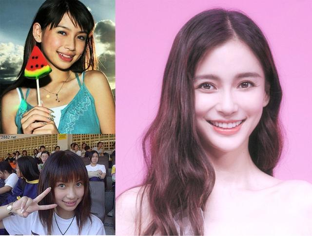 整容|长得“歪瓜裂枣”,整得“如花似玉”,这些女星都靠脸逆天改命