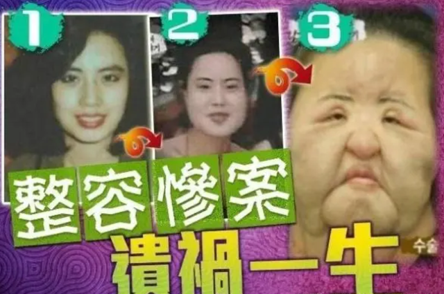 韩慧景|痴迷整容15年,把脸整成“电风扇”后遗症明显,韩慧景后悔了吗?