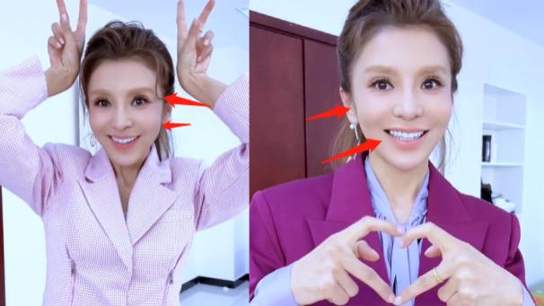 朱迅|49岁央姐朱迅晒新年开工照！嘴歪脸僵眼凹认不出，满脸倦容显病态