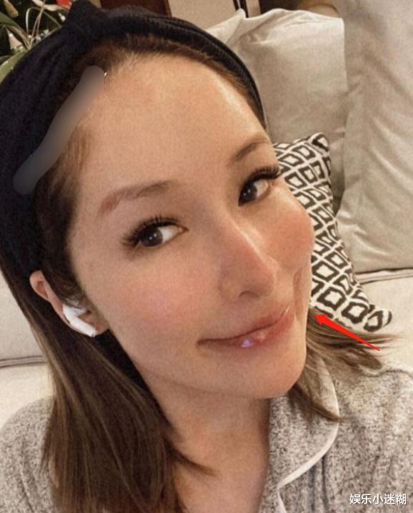 萧亚轩|半永久伤痕！萧亚轩被狗咬脸后首直播，网友：像少了一块肉