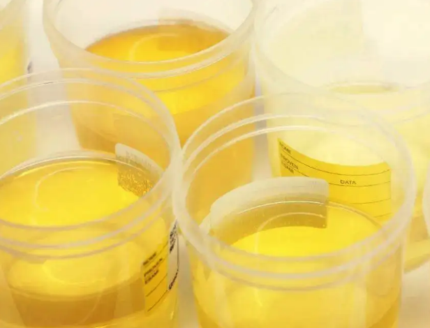 肝脏|肝不好的人能吃玉米吗?医生:不想肝脏硬化,3种食物要远离