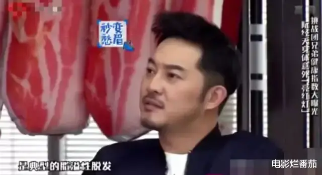 发际线|“秃顶”危机的10大男神，有人29岁发际线堪忧，有人常年戴假发套