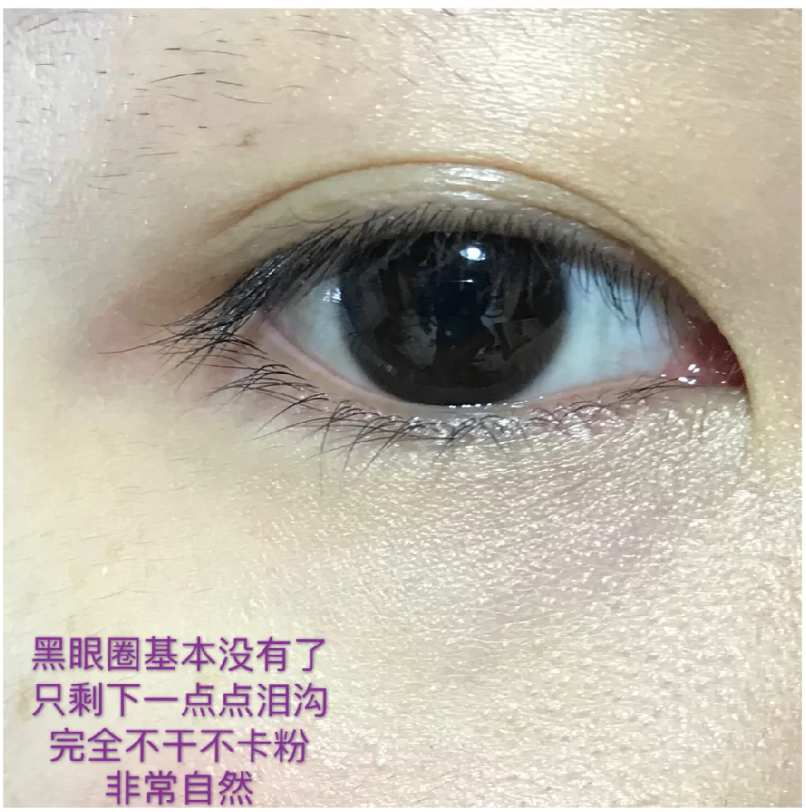 土豆 哪款平价遮瑕最好用？怎么挑选平价遮瑕？热门遮瑕液的真实测评 。