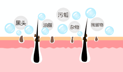 护肤 护肤干货！毛孔堵塞怎么办①