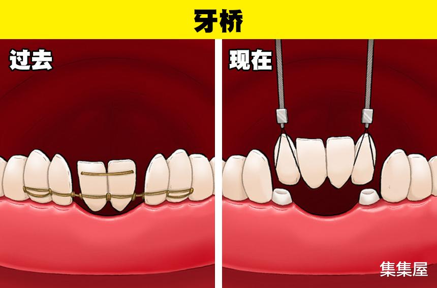 9个常见事物几十年,甚至几千年来发生的变化