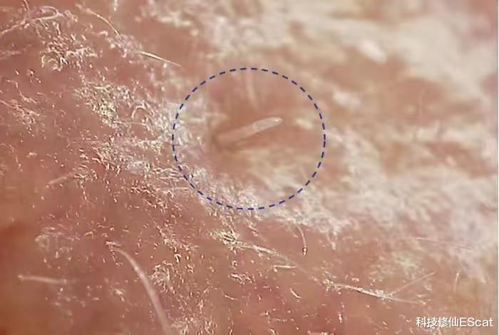 科学家:在我们脸上交配的螨虫正慢慢与人类融为一体!这么恶心?