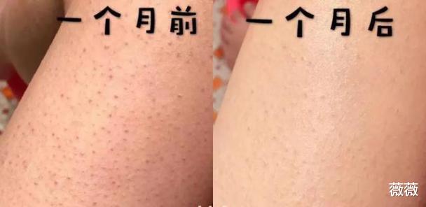 护肤品 因包装丑被“打入冷宫”的护肤品,在日本卖出“天价”,资生堂地位不保