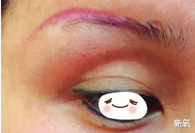 植发 秃不秃？纹发缝到底能不能撬动视觉发量？