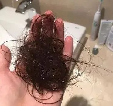 你真的会选防脱产品吗？热门方法产品跟着用，每天生发超500根，拒绝踩雷！！