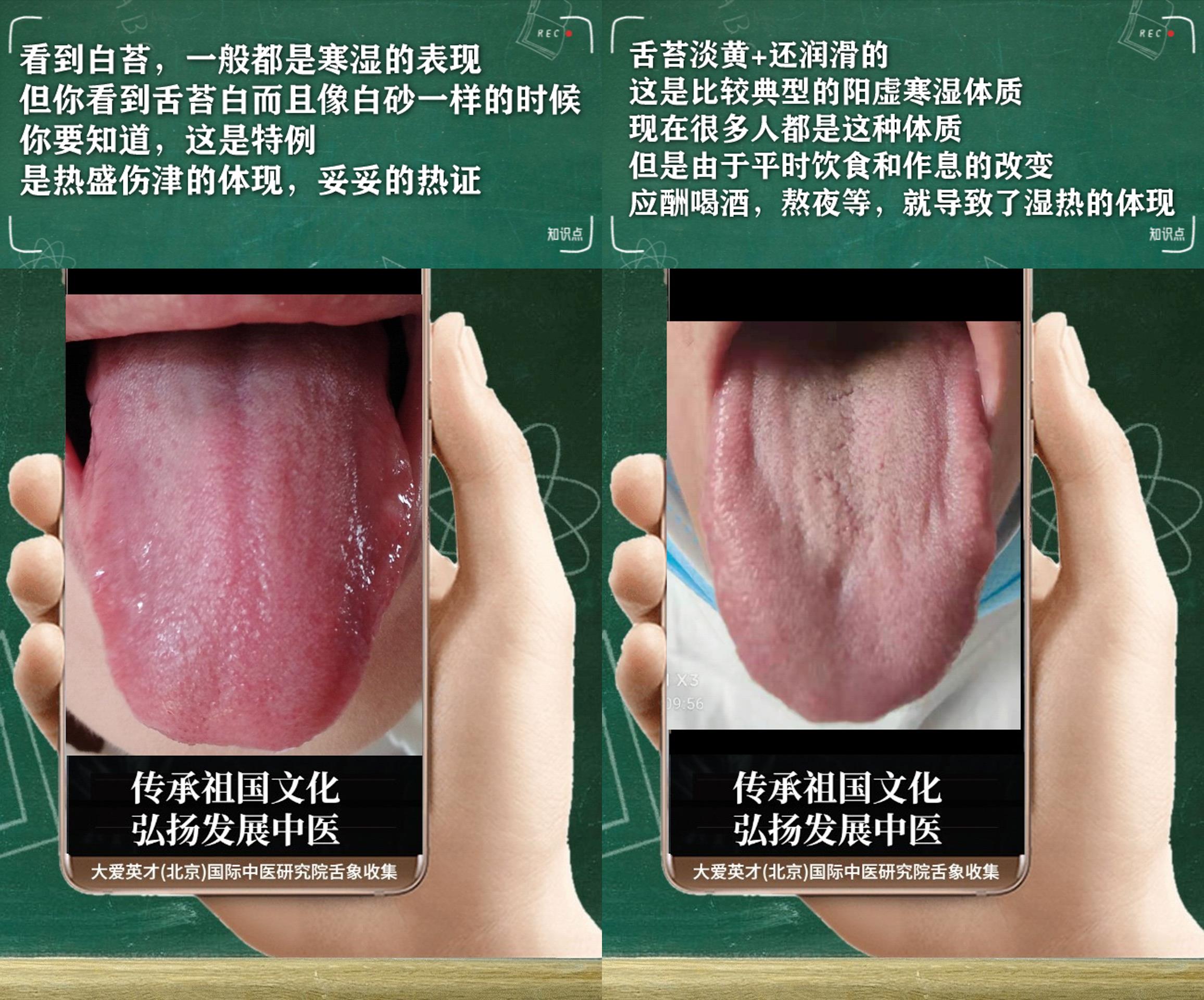 咳嗽|中医实例:经常感到胸闷,咳嗽,湿热下注,心脾不和