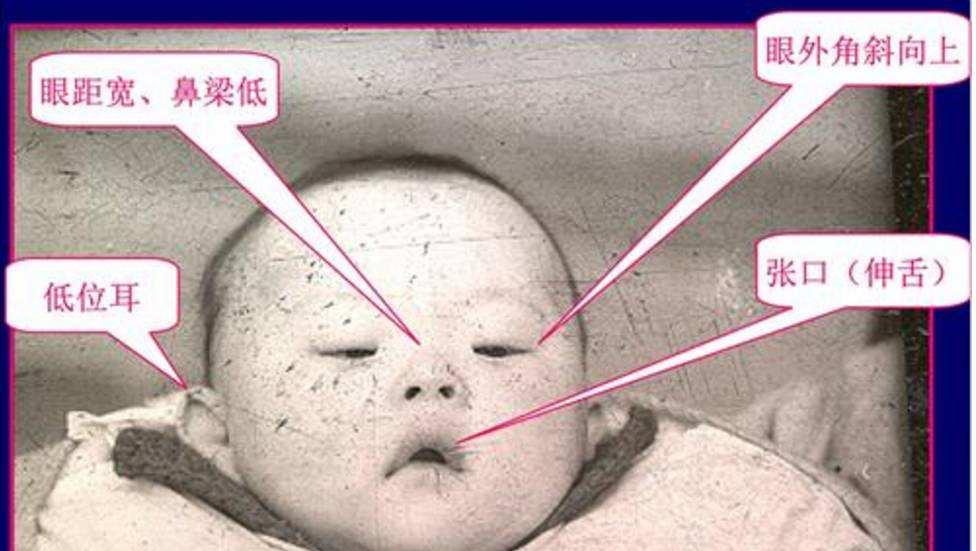 2017年,广东83岁老妇毒杀小儿子后被捕判刑,现场的人却为她求情
