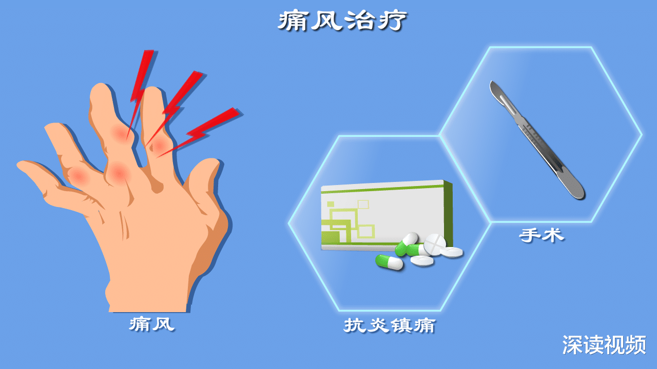 运动|痛风没得治？抗炎镇痛降尿酸？手术取石？痛风治疗门道多，全解读
