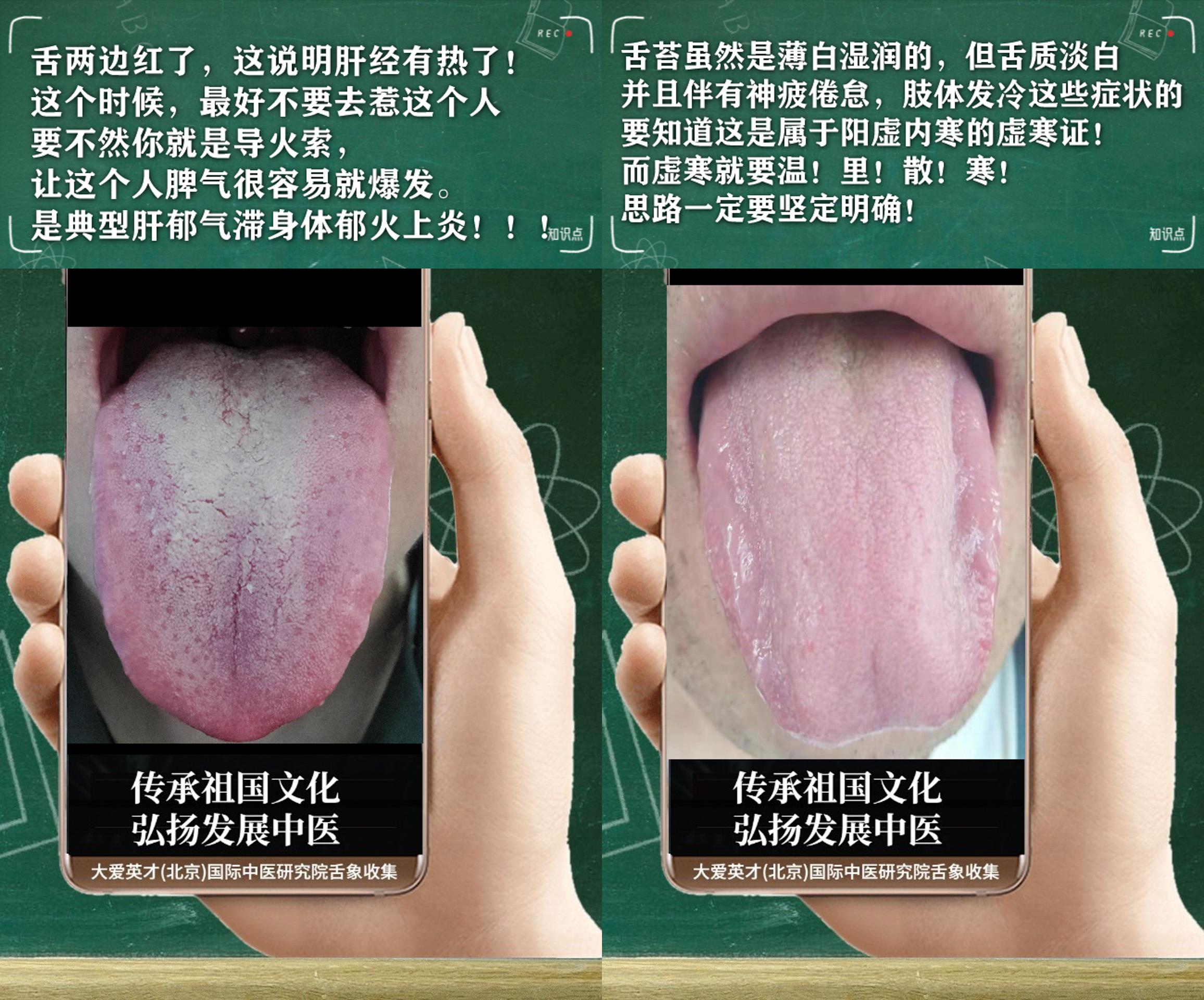 内分泌失调|中医医案:易愤怒、内分泌失调、慢性鼻炎、时好时差很影响生活