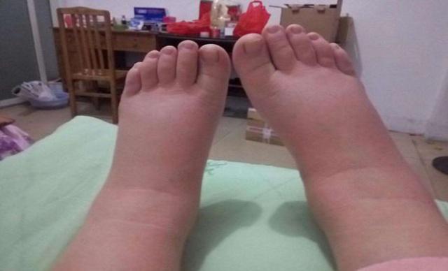 睡眠|尿酸太高的人,睡觉的时候会出现多处改变,需引起重视