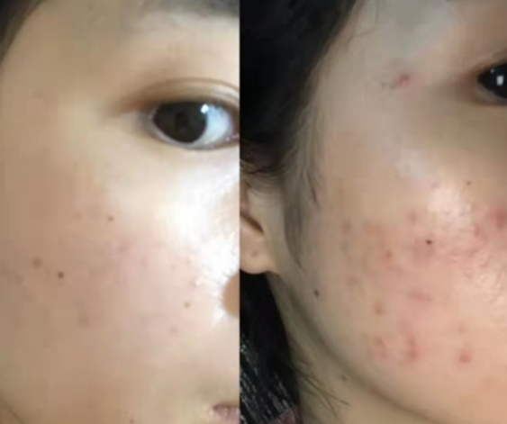 孕妇 孕期护肤毁容了?曝光“孕妇专用”惊天骗局!99%的宝妈都中过招