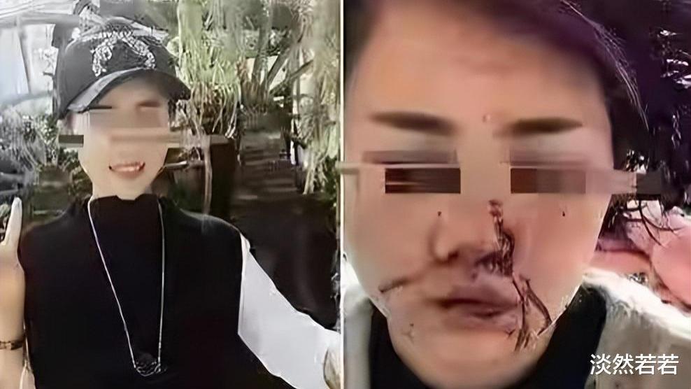 唐山事件被打女生或将无法自理，涉案人员必将判重刑，什么伞都不好使