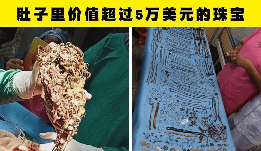 在人类的身体里,被找到的7个令人意外的事物