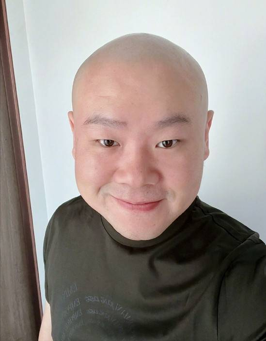 张艺兴|岳云鹏患脂肪瘤后暴瘦！瘦出尖下巴肚腩消失，疑无缘虎年央视春晚