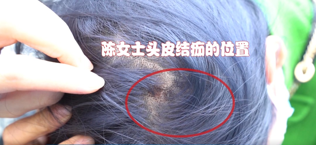 染发 这是她染发最久的一次，染了11个小时，但出来的效果却让她十分不满意。