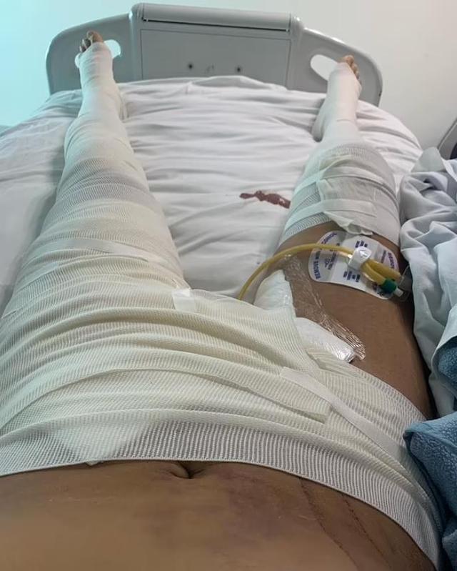 |浪漫度假变惊恐噩梦！她潜水时被螺旋桨击中，肌肉像被\切片\！
