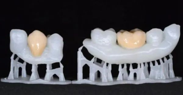 5G|3D打印在牙科领域的7大应用，你知道吗？