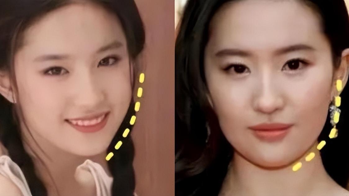 眼影 高颧骨真不算什么，“发腮”才最“致命”！颜值前后差距真不小