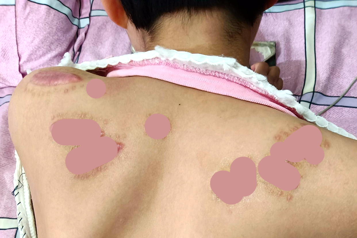 装死逃生!9岁女孩“被砍21刀”重伤:凶徒“疑精神病”已出院!