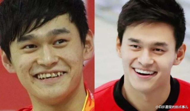 傅园慧|整牙等于换脸?看了判若两人的傅园慧,原来我们误会Baby了