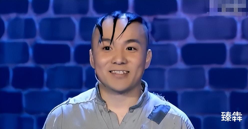 |童星“三毛”34岁了!8岁爆火14岁谢顶,植发挨300多针,今成帅哥