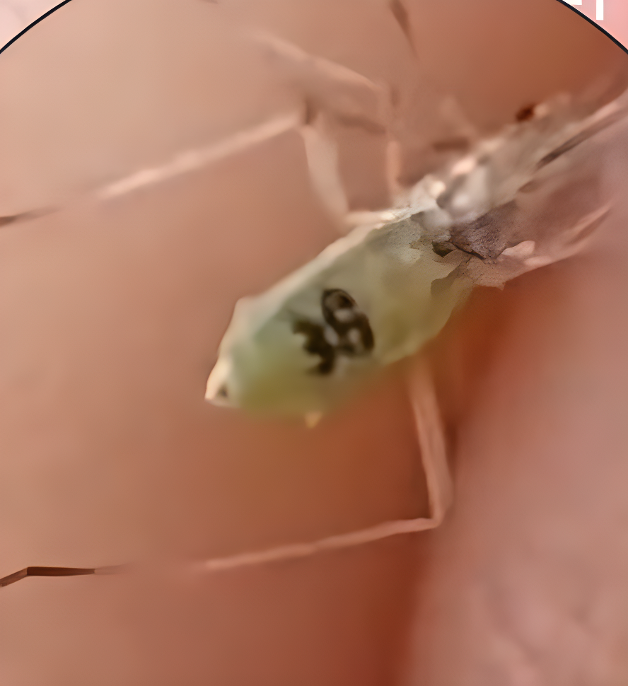 俄罗斯发现编号为“38”号的蚊子?真的是生物基因武器吗?