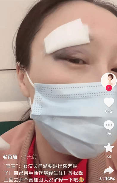 肖涵|脸上缝9针！35岁女星出意外称亲手断送演艺生涯，肖涵要退圈了？