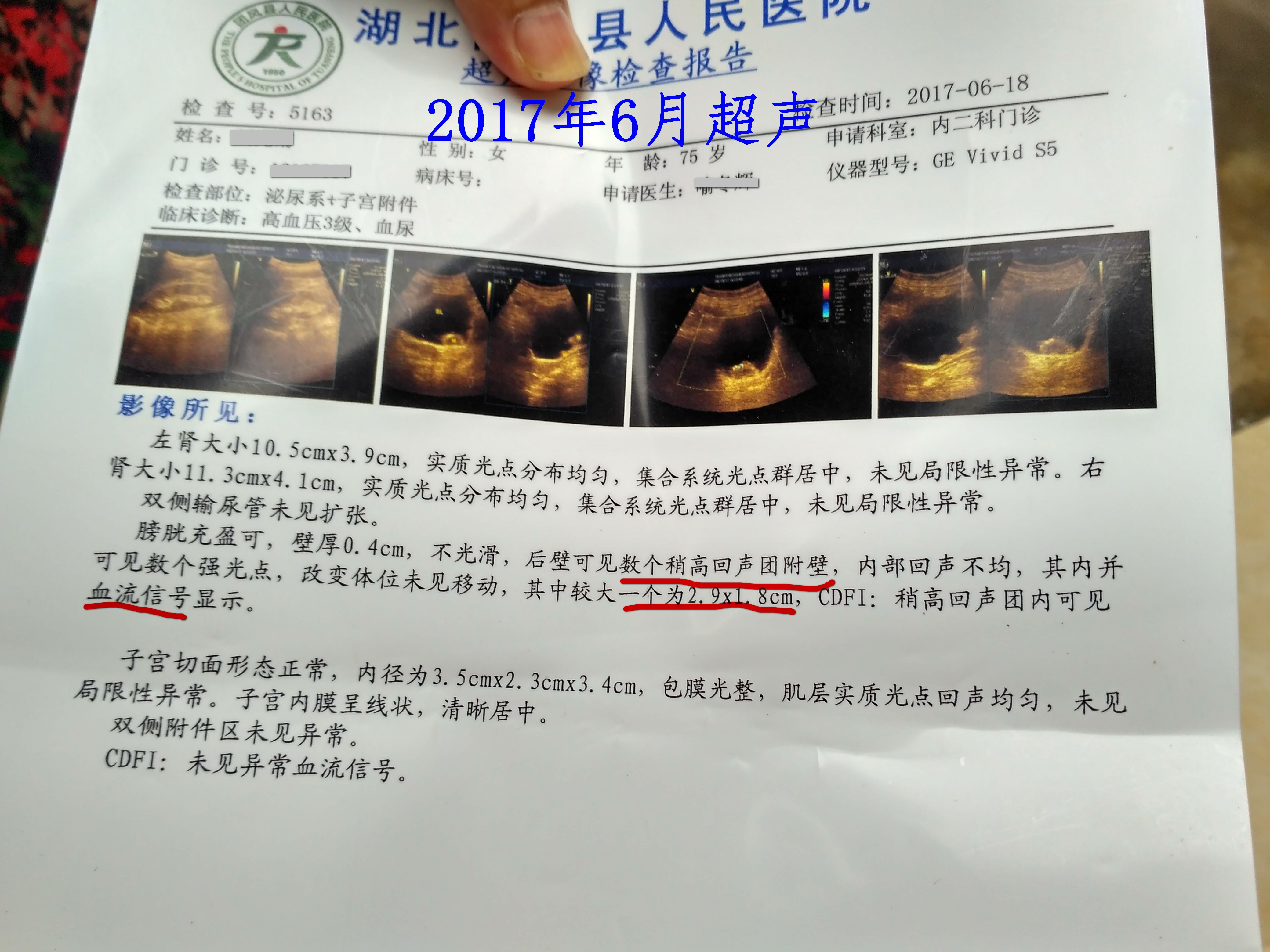 猪肉|膀胱肿瘤不手术,只吃中药行不行?