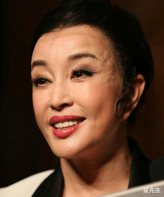 街拍|6位老年“整容脸”明星，面部僵硬、笑不出来、嘴歪，实在没法看