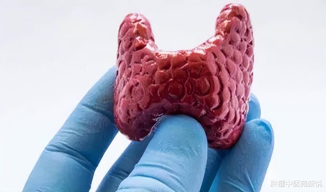 长寿|吃大蒜对甲状腺结节有好处?提醒:2果2蔬换着吃,或能化瘀散结