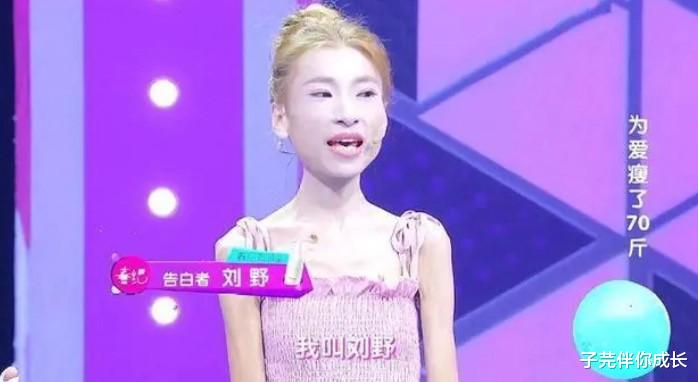 女孩 “骷髅妹”刘野：从120暴瘦到58斤，为爱痴狂，结局比想象的心酸