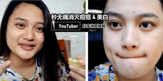 祛痘 祛痘产品哪个品牌效果好？COS评选真正有效的祛痘产品排行榜