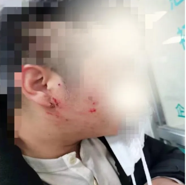 辽宁大连，男子为制止做核酸插队的一家4口，被对方父子2人按倒在地殴打