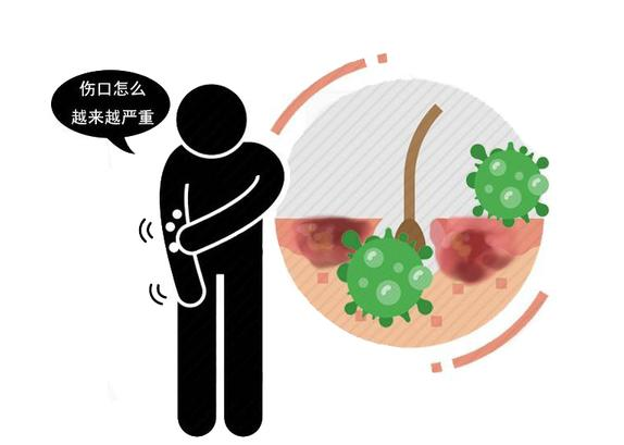 胰腺癌|它被称为“癌症之王”！身体出现4个信号，不能拖，尽快就医