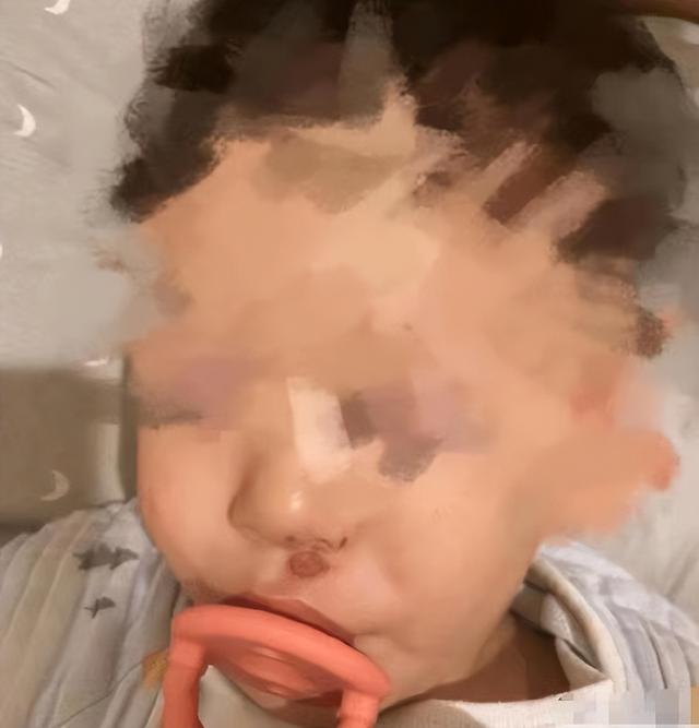 郑星源|张恒起诉郑爽虐待女儿，爆出孩子缝针伤口，伤口有6厘米