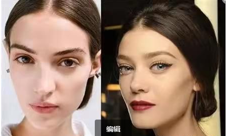 疾病|广运整形拉皮除皱的价格?拉皮的方法与步骤