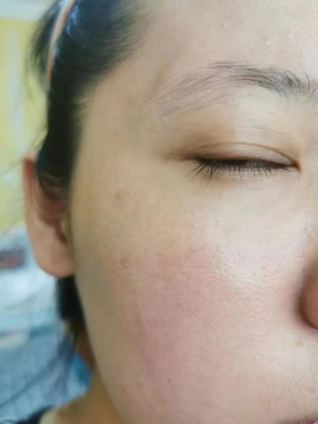 按摩 海报试用｜这套Whoo后秘贴精华是不是雷？听报友说