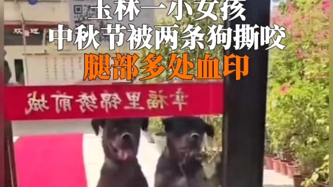 太震惊了 ！两只恶犬撕咬女孩……
