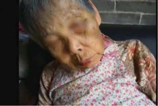 河南一位80多岁的老人,经常受到儿媳的虐待,但儿子始终对此袖手旁观