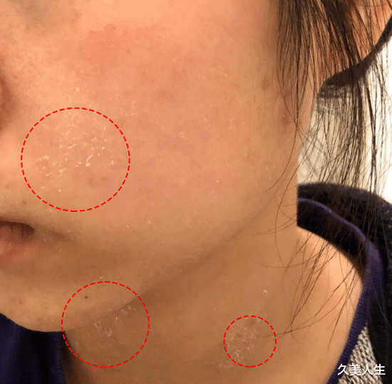 护肤品 小心点!你的护肤品存在烂脸黑名单上了吗?