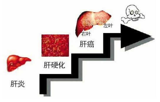 癌细胞|经常得这5种病的人，癌细胞可能会登门拜访，早知早治为好