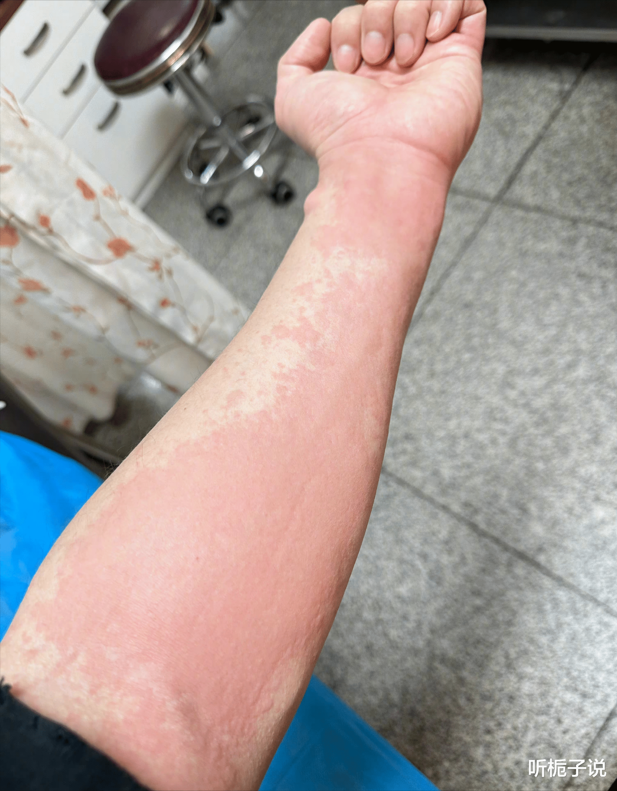 黄晓明|病从口入?离婚半年多的黄晓明,前脚分享美食,后脚就进医院